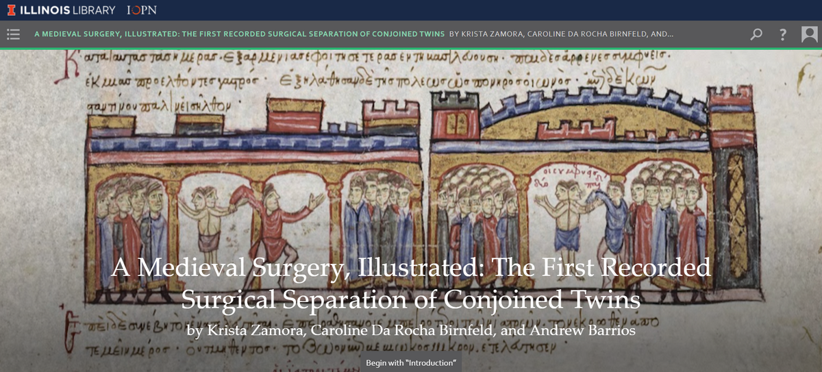 the SourceLab edition, A Medieval Surgery Illustrated: The First Recorded Surgical Separation of Conjoined Twins